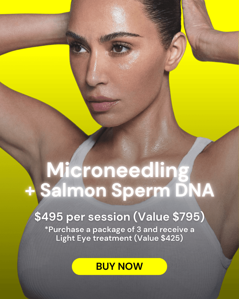 Microneedling + Salmon Sperm DNA Special - $495 (Regular $795) - Monarch MD Medical Aesthetics