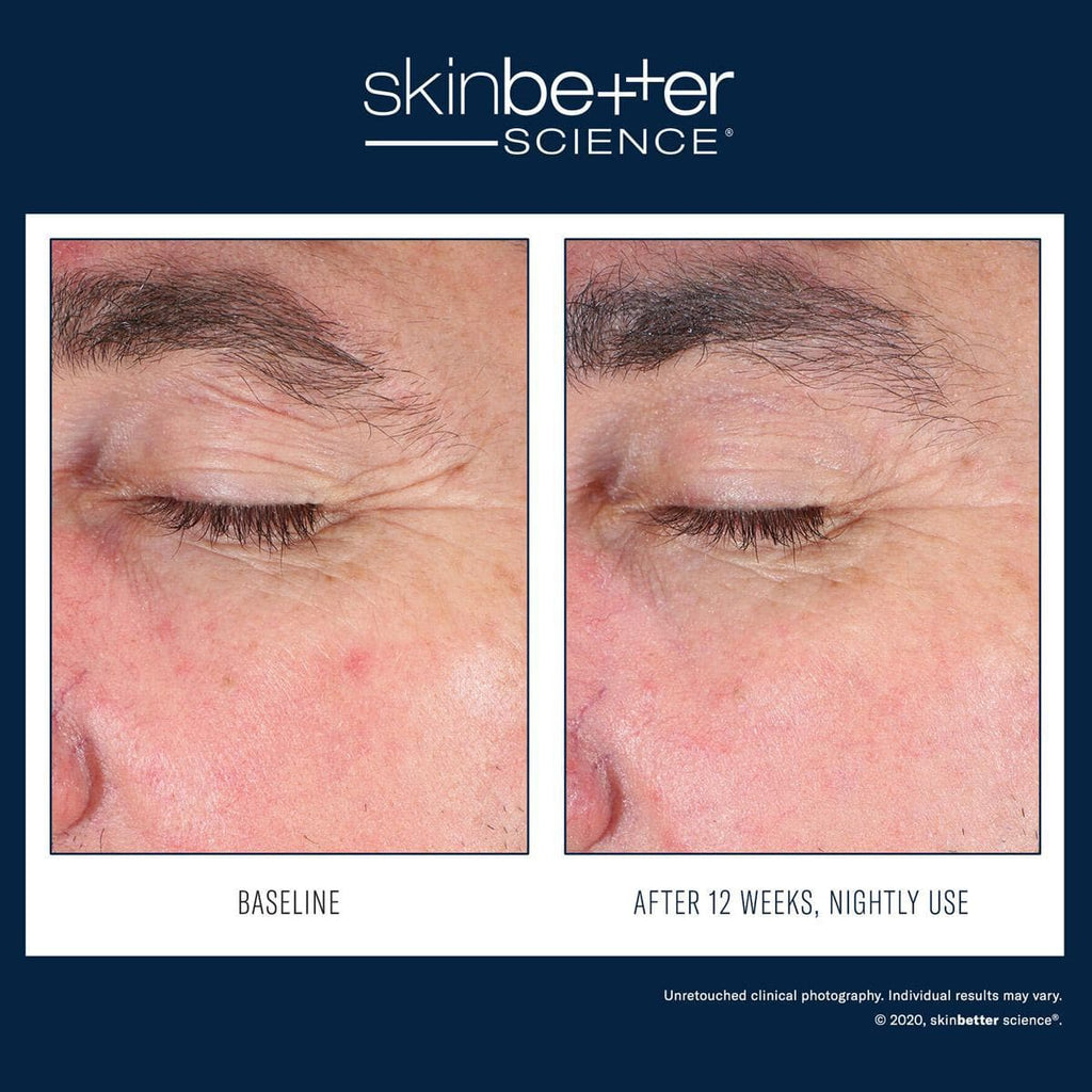 Skinbetter Science - EyeMax AlphaRet Overnight - Monarch MD Medical Aesthetics by Double Board Certified Facial Plastic Surgeon Dr. Eli Akbari MD, FRCSC