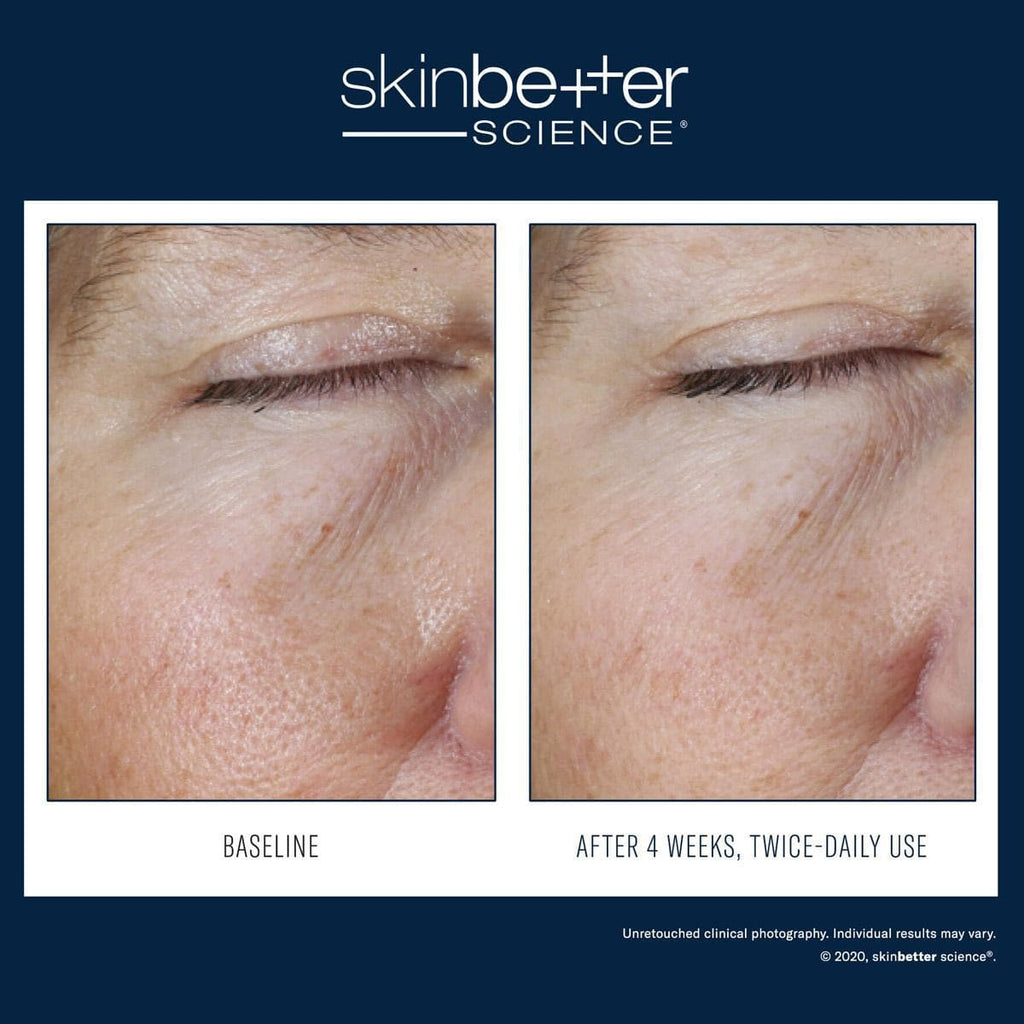 Skinbetter Science - Instant Effect Eye Gel - Monarch MD Medical Aesthetics by Double Board Certified Facial Plastic Surgeon Dr. Eli Akbari MD, FRCSC