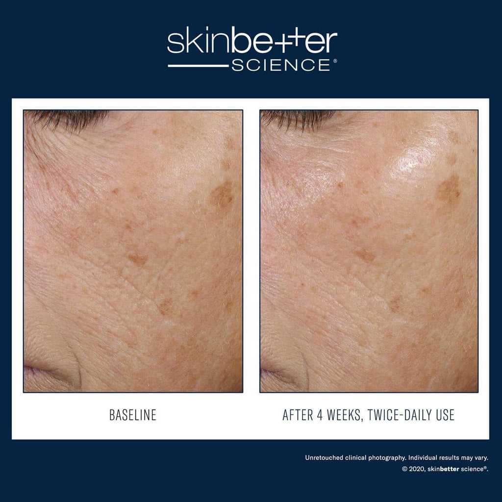 Skinbetter Science - Trio Rebalancing Moisture Treatment - Monarch MD Medical Aesthetics by Double Board Certified Facial Plastic Surgeon Dr. Eli Akbari MD, FRCSC