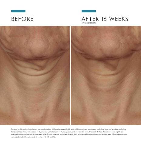 SkinCeuticals Tripeptide-R Neck Repair - Monarch MD Medical Aesthetics by Double Board Certified Facial Plastic Surgeon Dr. Eli Akbari MD, FRCSC