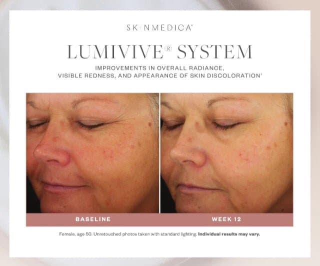 SkinMedica Lumivive™ System Day+Night - Monarch MD Medical Aesthetics by Double Board Certified Facial Plastic Surgeon Dr. Eli Akbari MD, FRCSC