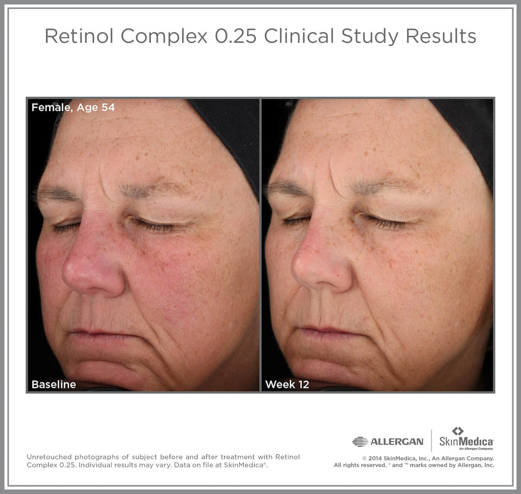 SkinMedica Retinol Complex - Monarch MD Medical Aesthetics by Double Board Certified Facial Plastic Surgeon Dr. Eli Akbari MD, FRCSC