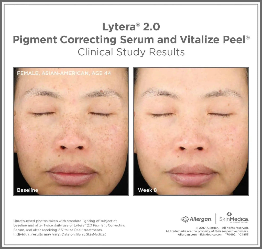 SkinMedica®Lytera 2.0 - Monarch MD Medical Aesthetics by Double Board Certified Facial Plastic Surgeon Dr. Eli Akbari MD, FRCSC