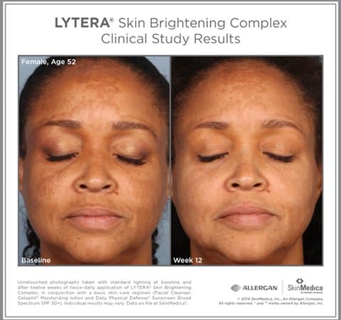 SkinMedica®Lytera 2.0 - Monarch MD Medical Aesthetics by Double Board Certified Facial Plastic Surgeon Dr. Eli Akbari MD, FRCSC