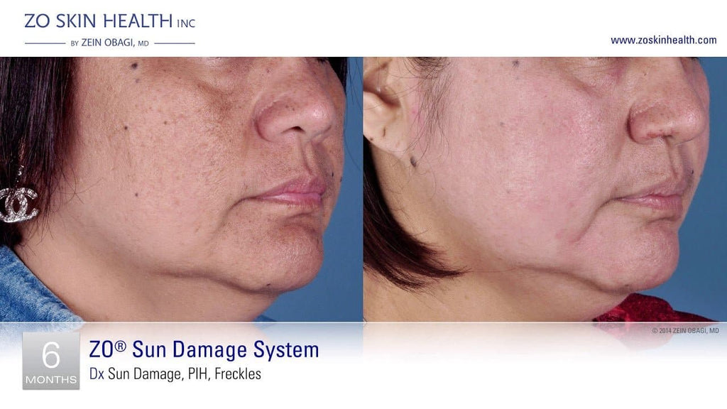 ZO Firming Serum - Monarch MD Medical Aesthetics by Double Board Certified Facial Plastic Surgeon Dr. Eli Akbari MD, FRCSC