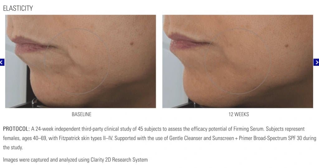 ZO Firming Serum - Monarch MD Medical Aesthetics by Double Board Certified Facial Plastic Surgeon Dr. Eli Akbari MD, FRCSC