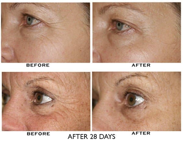 ZO Growth Factor Serum Eye - Monarch MD Medical Aesthetics by Double Board Certified Facial Plastic Surgeon Dr. Eli Akbari MD, FRCSC