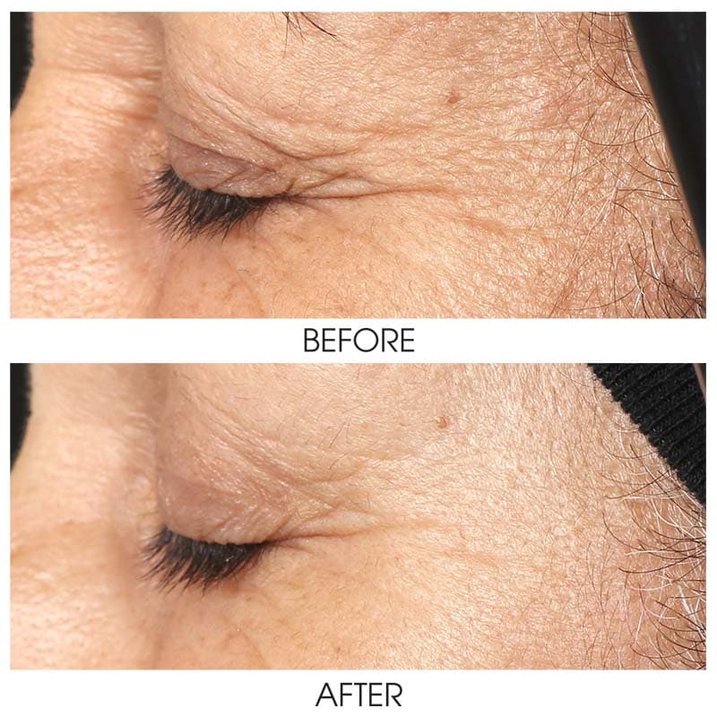 ZO Growth Factor Serum Eye - Monarch MD Medical Aesthetics by Double Board Certified Facial Plastic Surgeon Dr. Eli Akbari MD, FRCSC