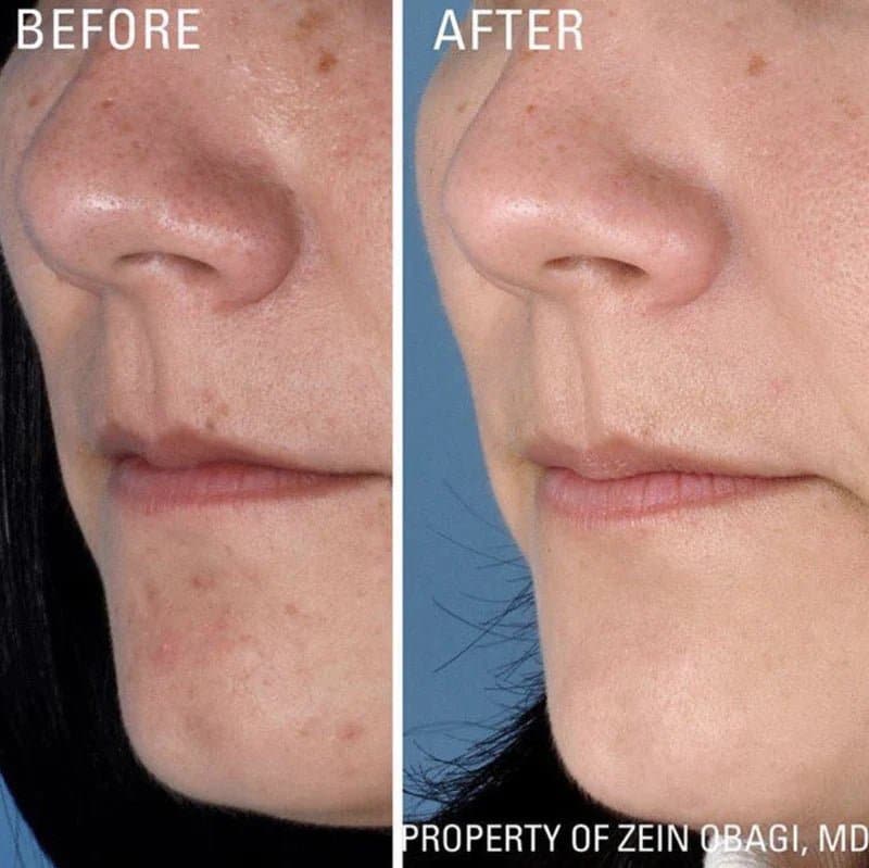 ZO Instant Pore Refiner - Monarch MD Medical Aesthetics by Double Board Certified Facial Plastic Surgeon Dr. Eli Akbari MD, FRCSC